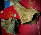 犀橈骨下端+犀脛骨下端